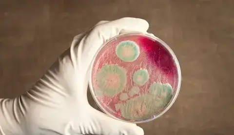 Исследование захоронения сибирской язвы в Байсерке: безопасность жителей под контролем {city2}