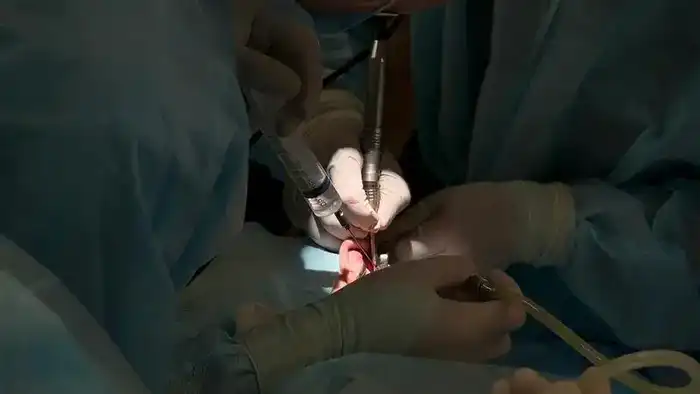 В Карагандинской области впервые провели операцию по восстановлению слуха ребёнку с помощью кохлеарной имплантации (5)