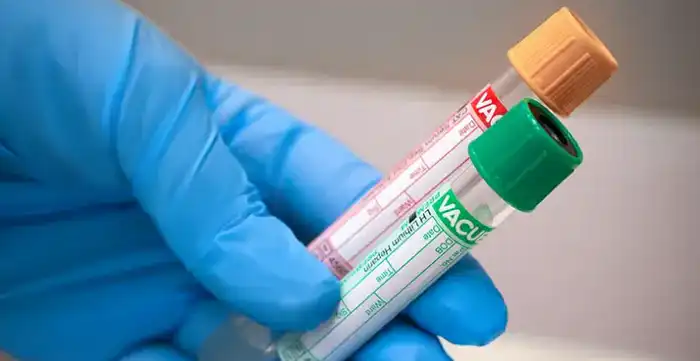 Защита конкуренции: меры по устранению злоупотребления доминирующим положением в сфере лабораторных услуг {city2}