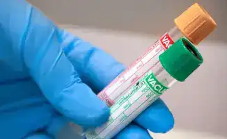 Защита конкуренции: меры по устранению злоупотребления доминирующим положением в сфере лабораторных услуг