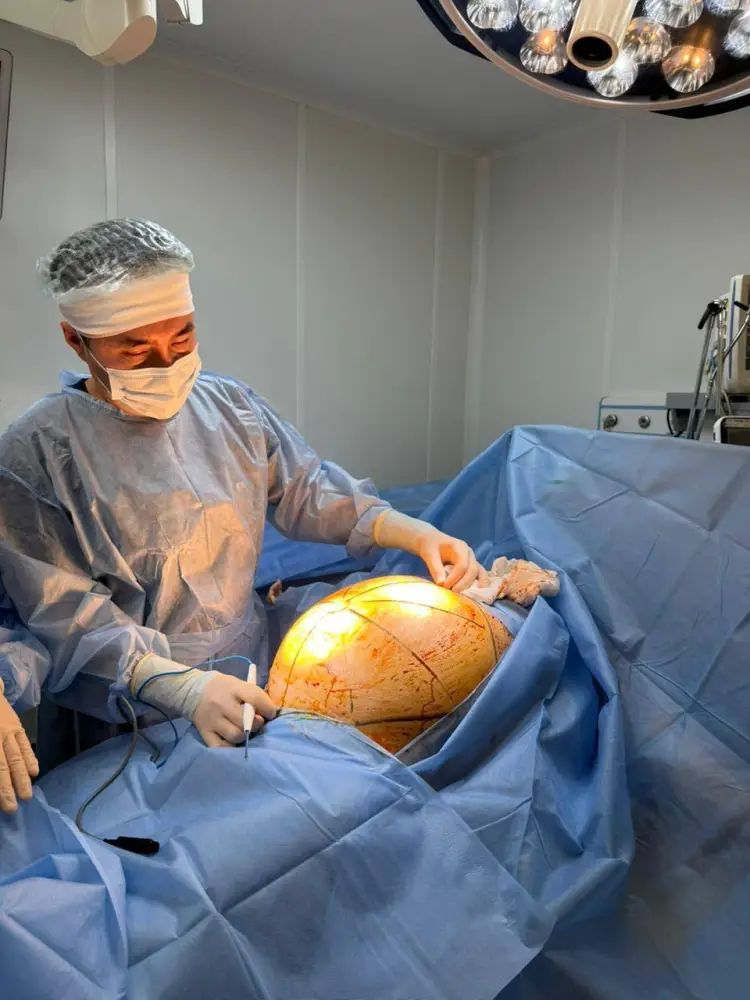 Проблемы традиционной медицины: пациентка из Алматы долго лечилась нетрадиционными методами перед удалением гигантской опухоли {city2}