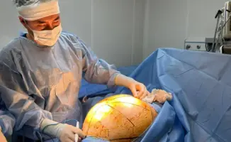 Проблемы традиционной медицины: пациентка из Алматы долго лечилась нетрадиционными методами перед удалением гигантской опухоли