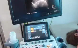 Медицинская акция в Илийском районе: бесплатные обследования и просвещение о здоровье на референдуме