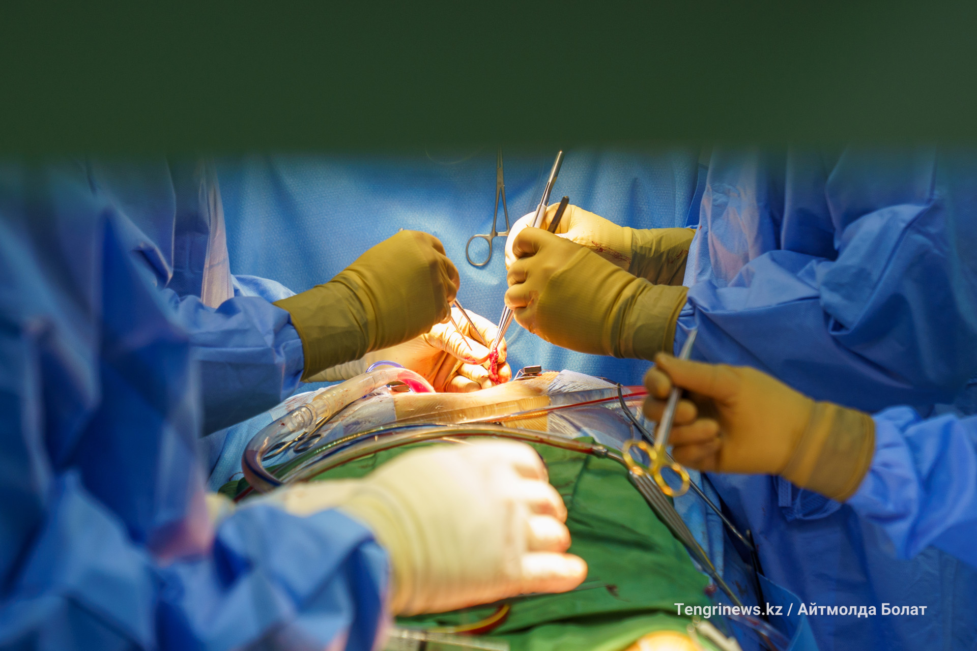 Операция на сердце 